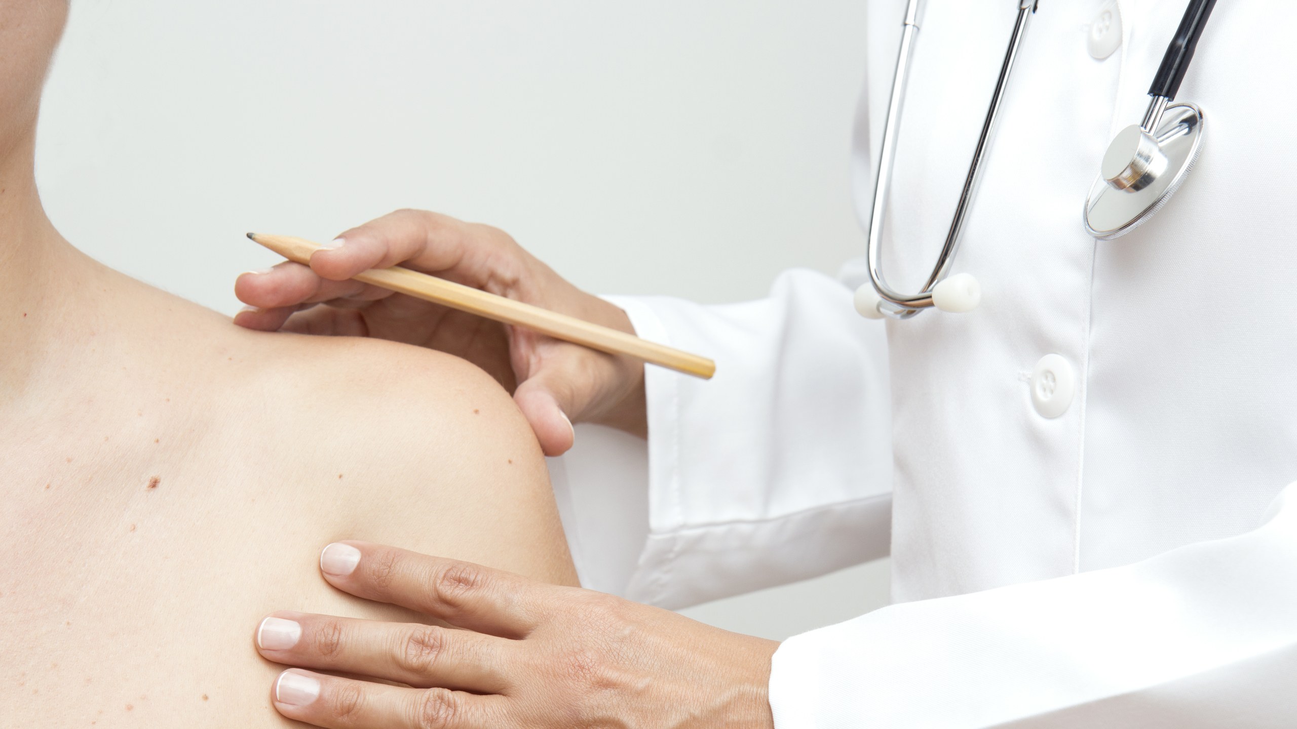 Best Tips To Get Rid Of Skin Tags - The Natural Way