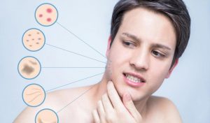 Skin Care Tips for Men