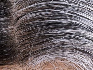 Healthy And White Hair