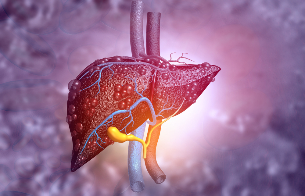 Fatty Liver Disease
