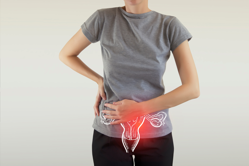 Ovarian Cancer