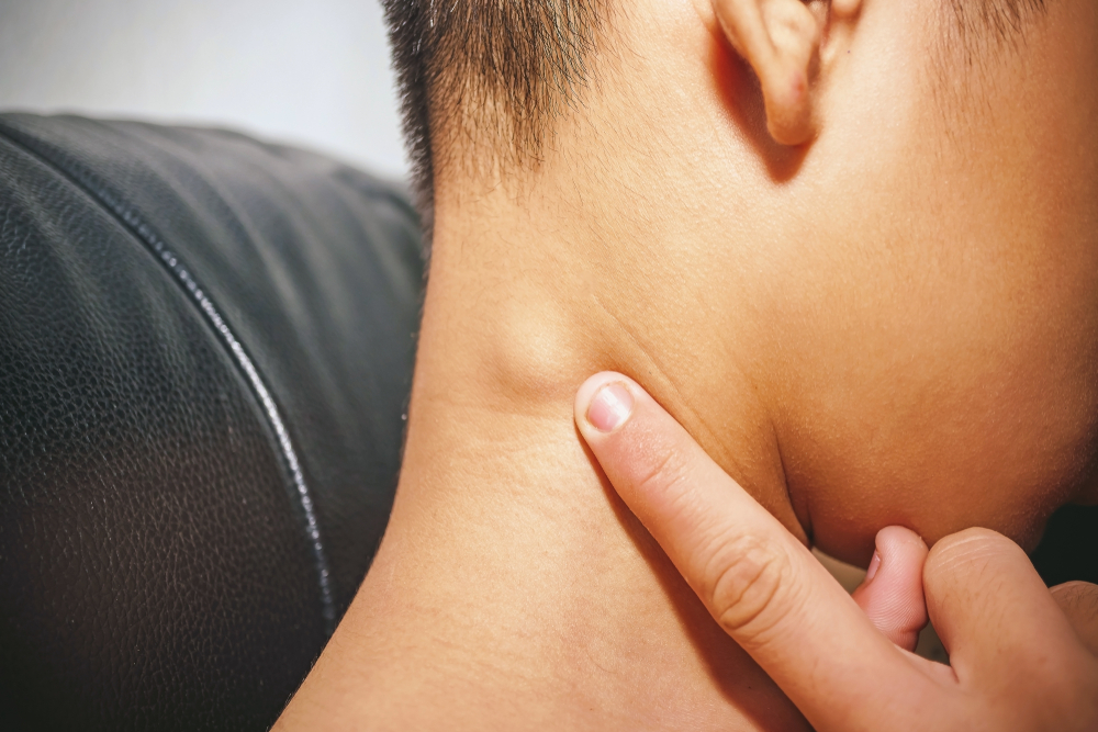 Lymph Nodes